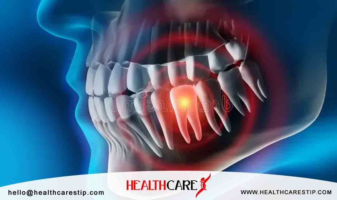 dental pain treatment