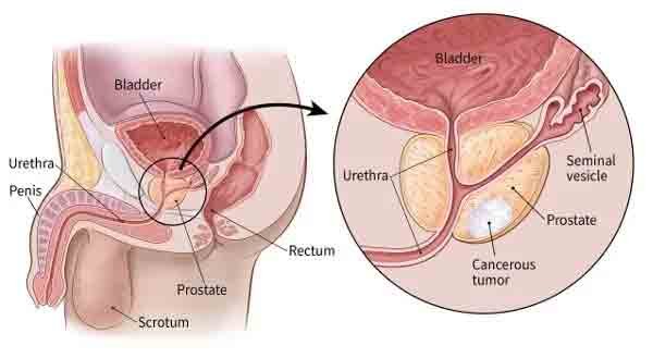 prostate health supplements