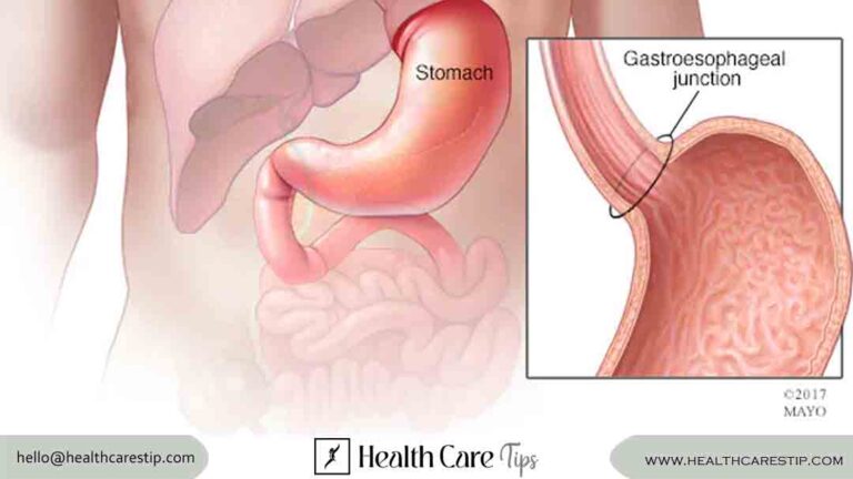 stomach cancer symptoms