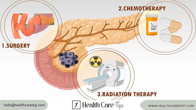 pancreatic cancer treatment